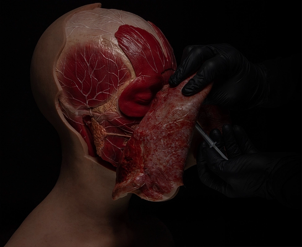 Introducing NeuroSCI: The Ultimate Therapeutic Injection Simulator for Chronic Migraine Relief Training