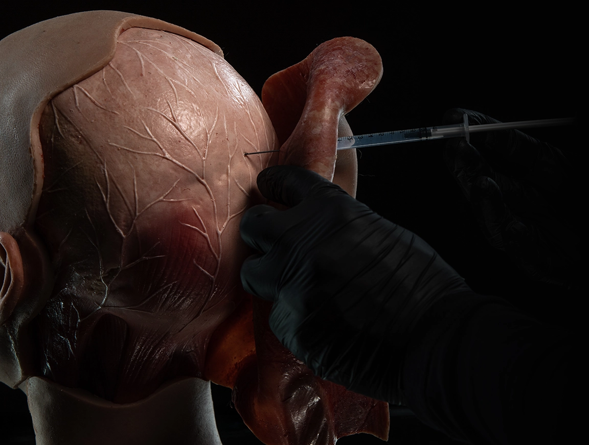 Introducing NeuroSCI: The Ultimate Therapeutic Injection Simulator for Chronic Migraine Relief Training